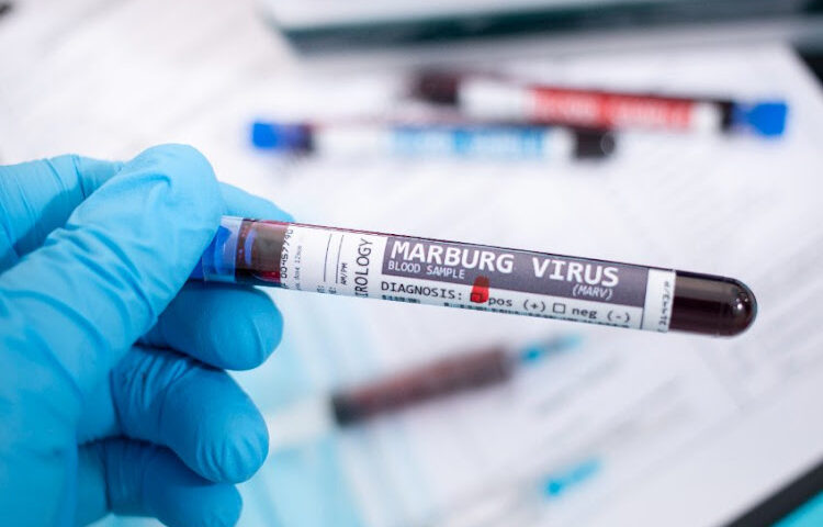 Marburg Virus Kills 6 In Rwanda- Health Minister Confirms